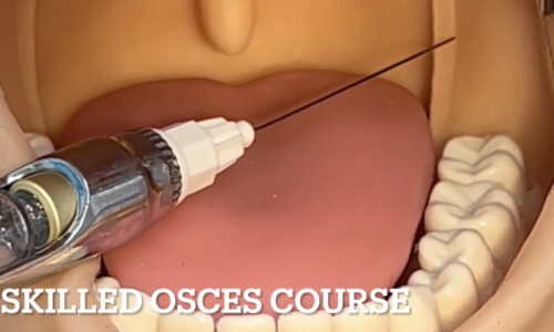 Skilled OSCES Local Anesthetic